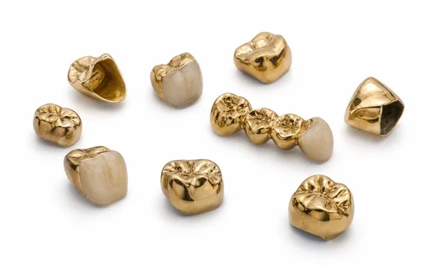 Zahngold verkaufen